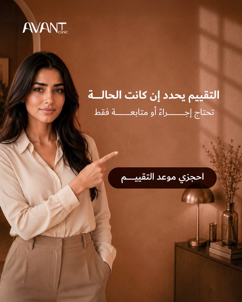 Y4 ٣