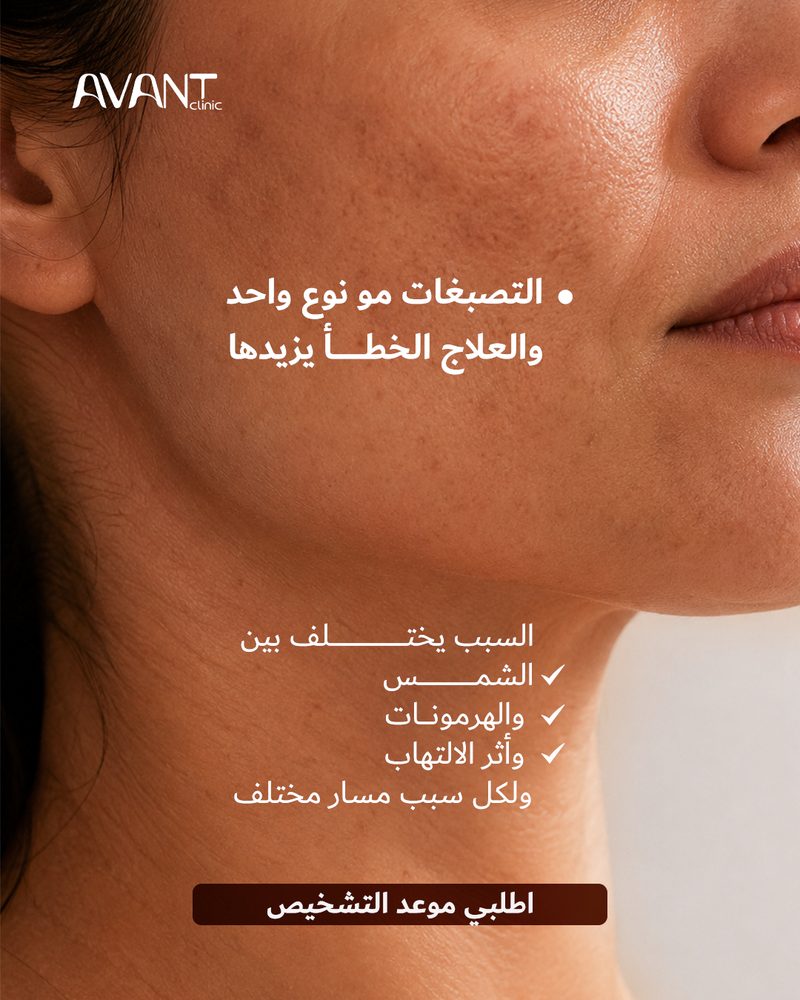Y5 ١